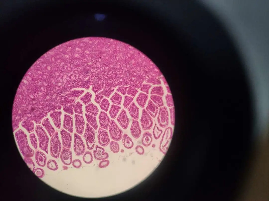 医学生学习打卡做题,医学生学习成果检验视频