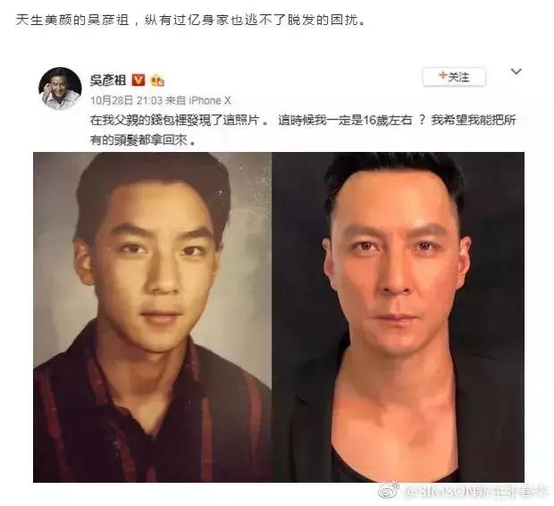 怎么拯救你我的发际线,如何通过改善发型拯救发际线