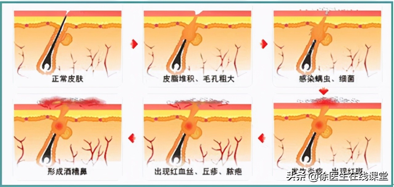 甲硝唑便宜又实用都能搞定哪些病,甲硝唑哪一种见效快图片