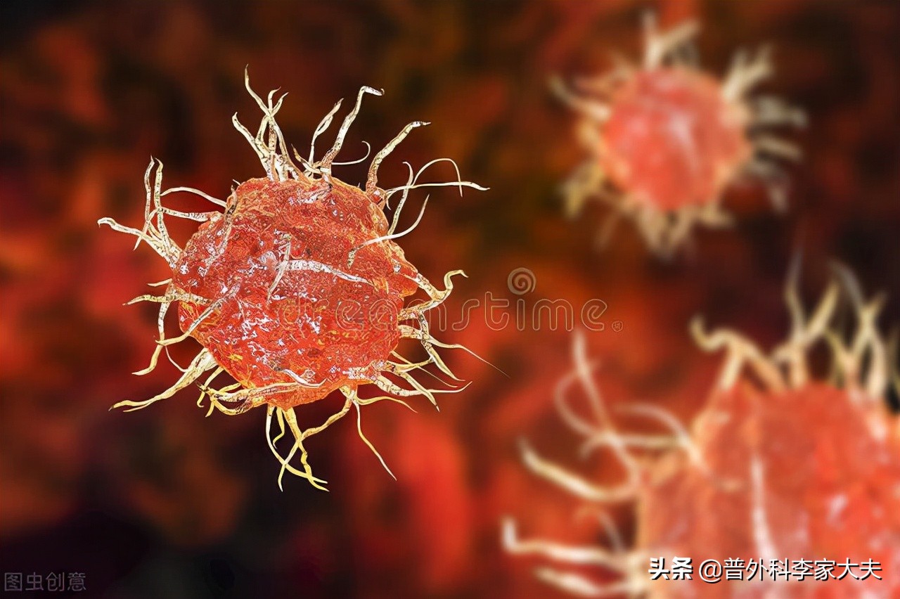 肺原位癌手术后要注意什么,肺癌原位癌手术切除后为何还复发