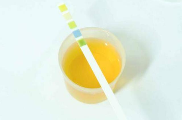 子宫好的女人，晨起小便可能会有4个“特征”，你都有吗？