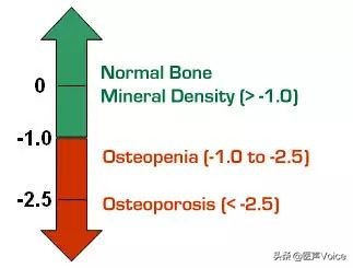 男性骨质疏松如何治疗,男性骨质疏松的治疗药