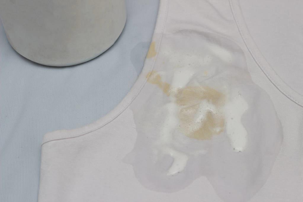 收藏！白色衣服清洗保养有妙招，轻松解决衣服发霉发黄油渍问题