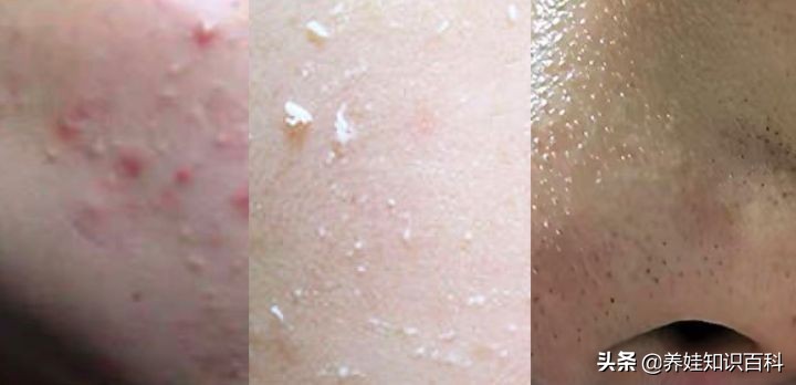 涓嶄慨榧绘瘺,涓嶅墐鑳″瓙涓嶄慨鐪夋瘺閭嬮噷閭嬮仮