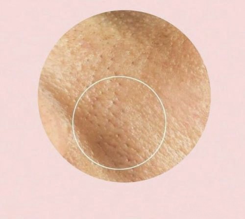 油皮毛孔粗大洗面奶,油皮毛孔粗大怎么补水