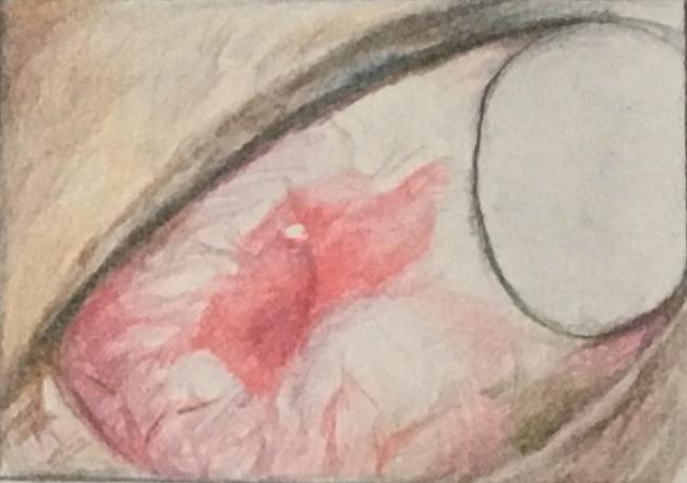 口腔黏膜溃疡反复发生吃什么药,反复口腔溃疡看风湿科有没有用