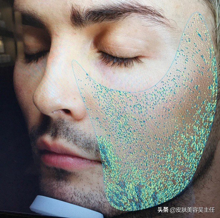 visia皮肤检测分高低吗,visia皮肤检测值多少是正常的