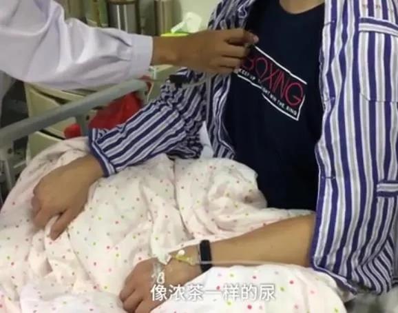 深蹲500个之后尿液变深,深蹲后第二天尿液深褐色