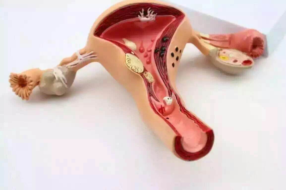 女性远离妇科疾病的3个方法,一招治妇科疾病