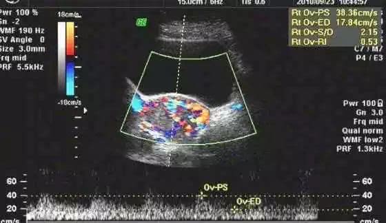 孕妇绝对不能坐在葡萄树下？坐葡萄树下会得葡萄胎？