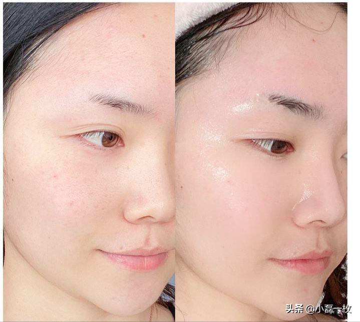 熬夜脸色蜡黄怎么改善最快最有效,脸熬夜蜡黄暗沉怎么调理