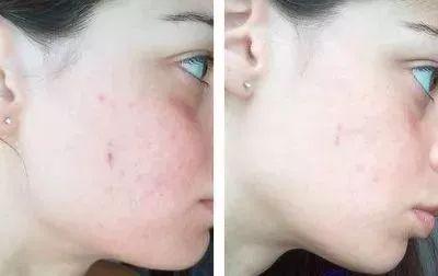 用了好多护肤品脸还是粗糙,化妆棉为什么越来越薄