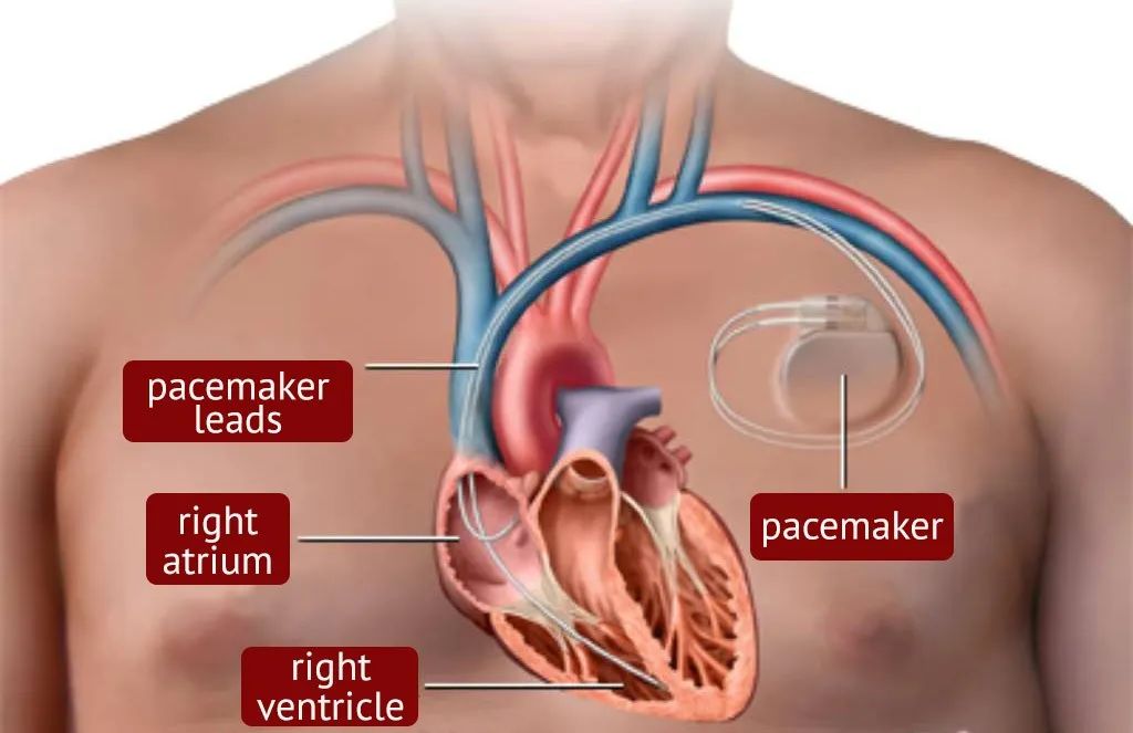 心脏供血不足心跳慢吃什么药,心跳慢心脏不舒服