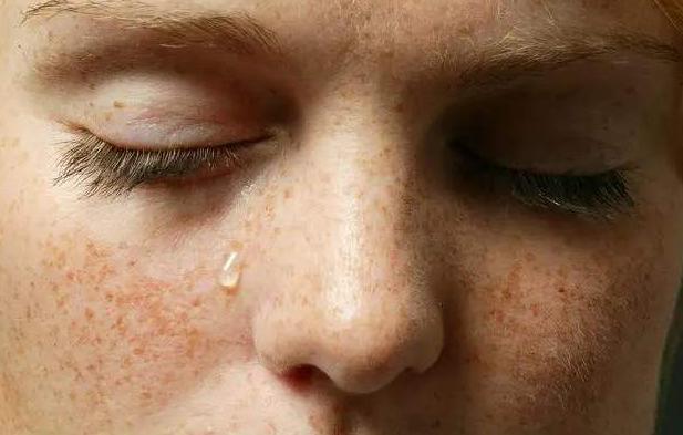 脸上的斑去哪里能看出是什么斑,脸上斑的分类及形成原因
