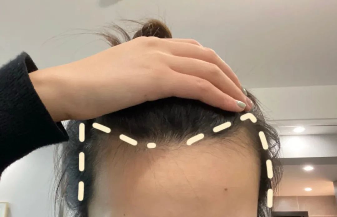 哪一款刘海好看适合所有脸型,减龄发型适合所有脸型有刘海