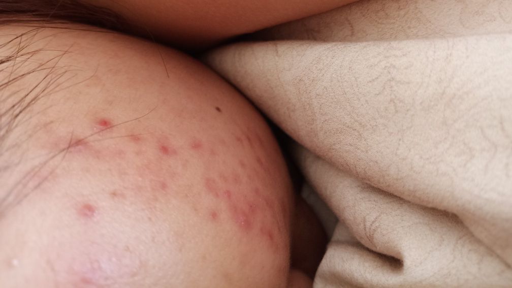 兰蔻极光水测评推荐真实,兰蔻极光水的功效