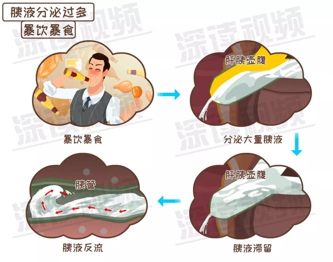 大吃大喝容易引发急性胰腺炎,月子期间胰腺炎是怎么引起的