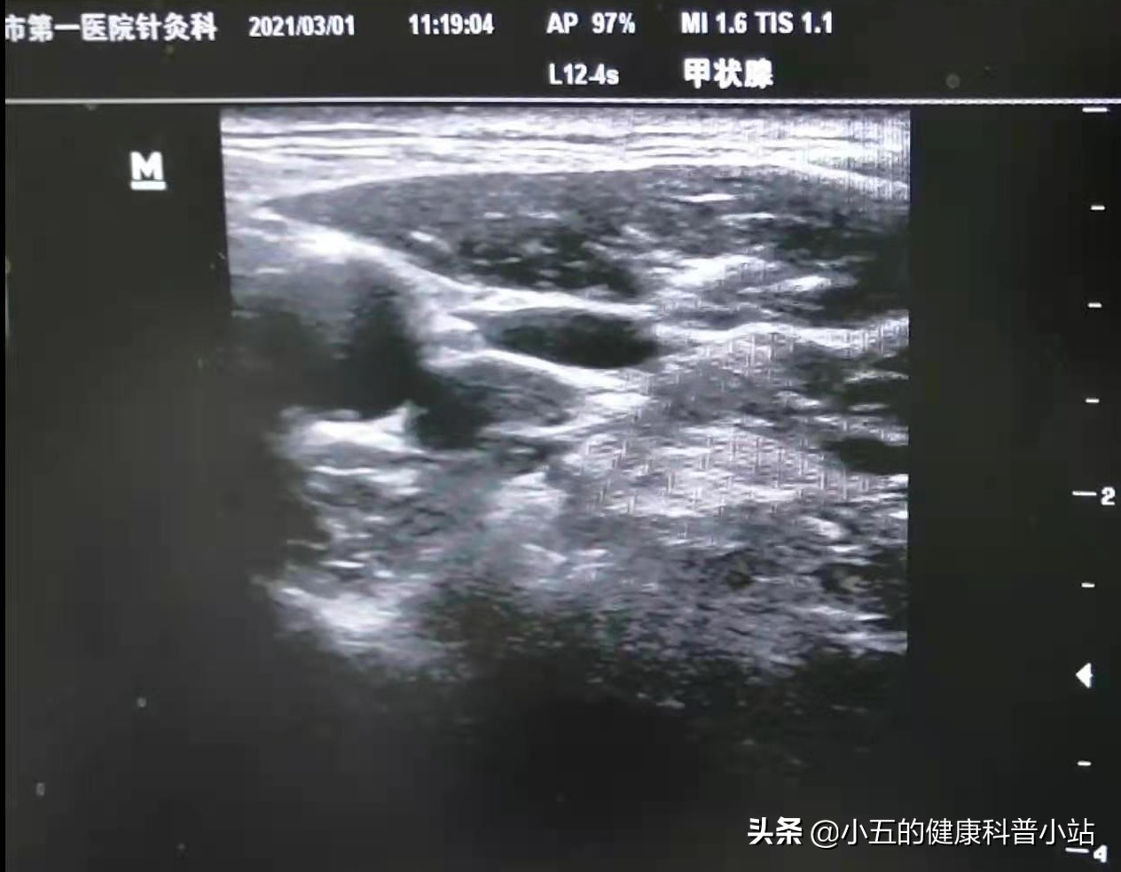 浜ㄧ壒缁煎悎寰佺殑鐗圭偣,浜ㄧ壒缁煎悎寰佺殑鐗瑰緛