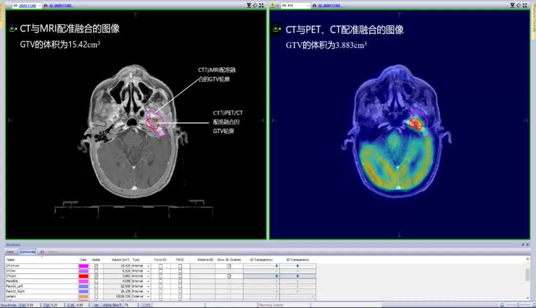 放射与核医学科,放射治疗研究中心