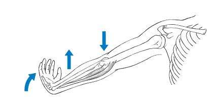 网球肘一定是打网球造成的吗,打网球如何防止网球肘
