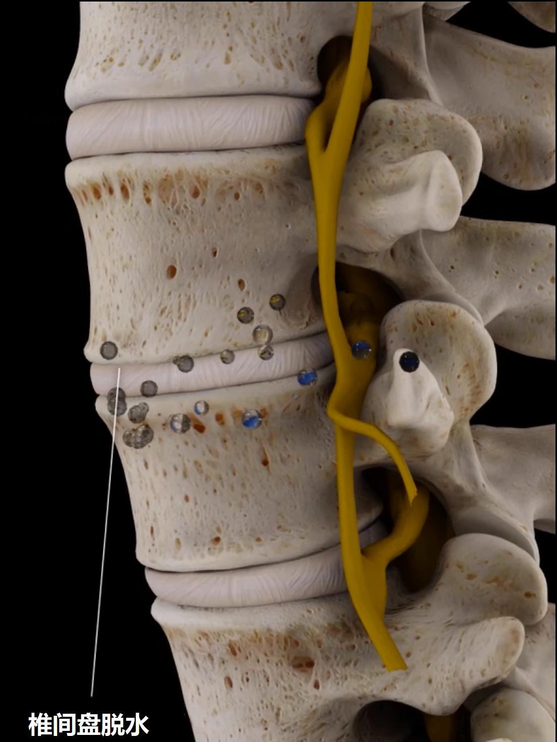 上班族该怎么预防腰痛,腰痛要警惕四种原因及治疗方法