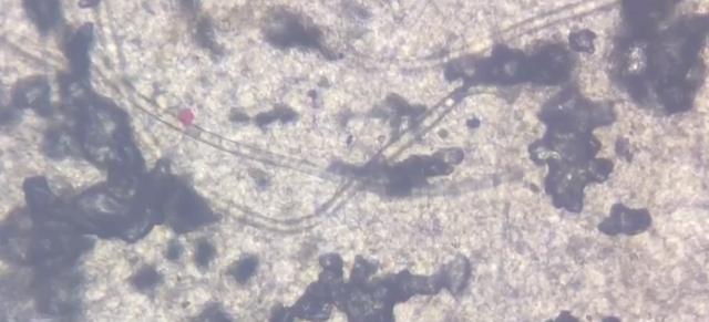 肚脐眼用显微镜放大1000倍,抠肚脐眼里的泥全过程