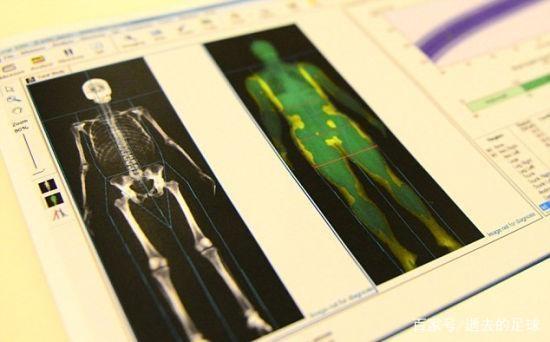 奥运金牌含金量科普,奥运金牌冷知识大全