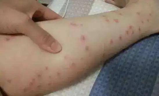 青草膏驱蚊止痒泰国正品,泰国进口青草膏居家旅游必备