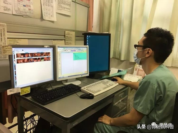 日本女人做胃镜,日本超细胃镜