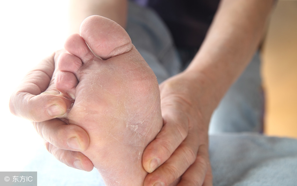 达克宁和皮康王哪个抗真菌效果好,金达克宁与达克宁哪个治真菌好