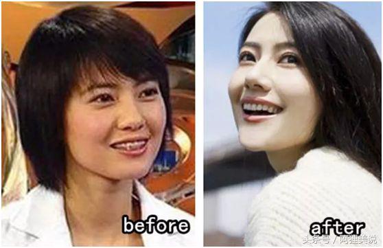 从3分到10分中间需要几分钟,从3分到4分付出了多大努力