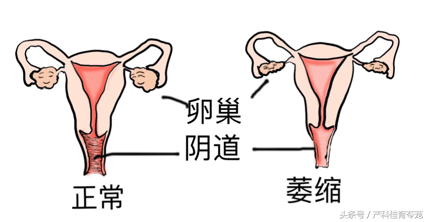 老年人阴道炎有什么症状吗,老年人阴道炎会有什么症状