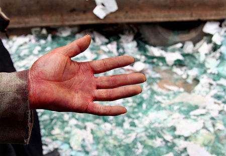 玻璃渣扎进心脏,玻璃渣子扎进血管多久会死