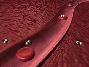 高血脂患者易忽视的七大误区,高血脂症的误区有几点