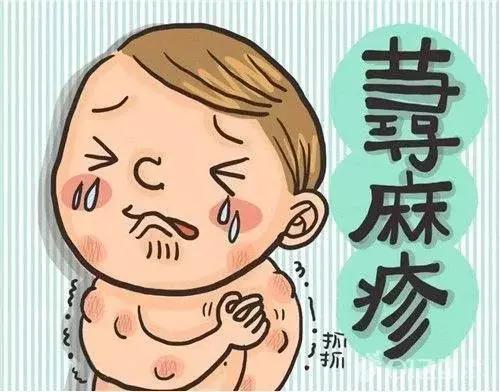 荨麻疹适合哪种益生菌,荨麻疹吃药控制住了突然又加重