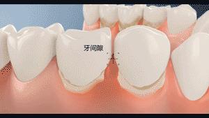 清洁钻石的方法,专门清洁牙齿顽固污渍