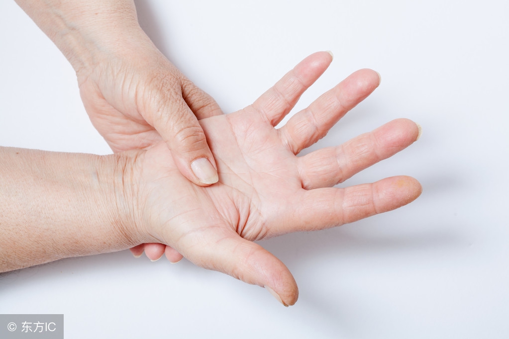 硬皮病怎么防治,硬皮病症状怎么治疗