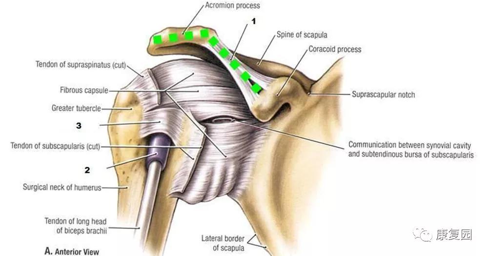 肩峰下撞击综合征的康复评估,肩峰下撞击综合征的康复方法