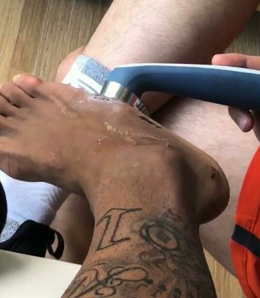 巴西内马尔受伤原视频,巴西球员受伤恢复了吗