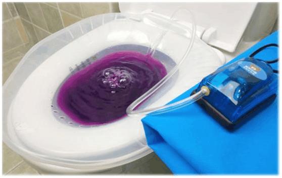 女生治疗痔疮全过程,女生痔疮的最佳治愈方法