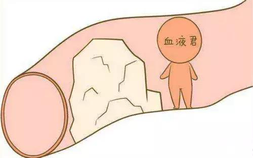 静脉曲张孕期需要注意什么,孕期打静脉曲张的针