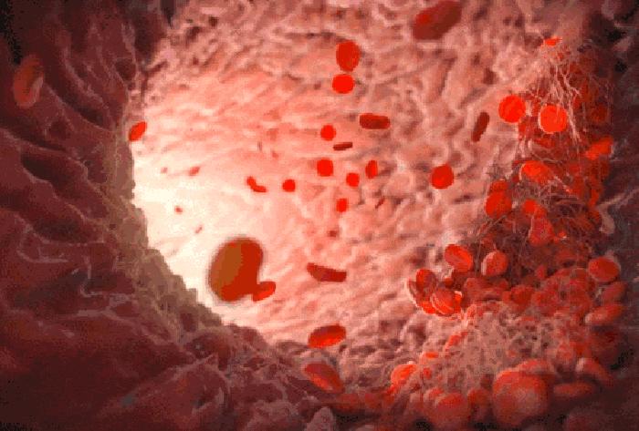 吃什么会导致血稠,遗传性血稠怎么调理