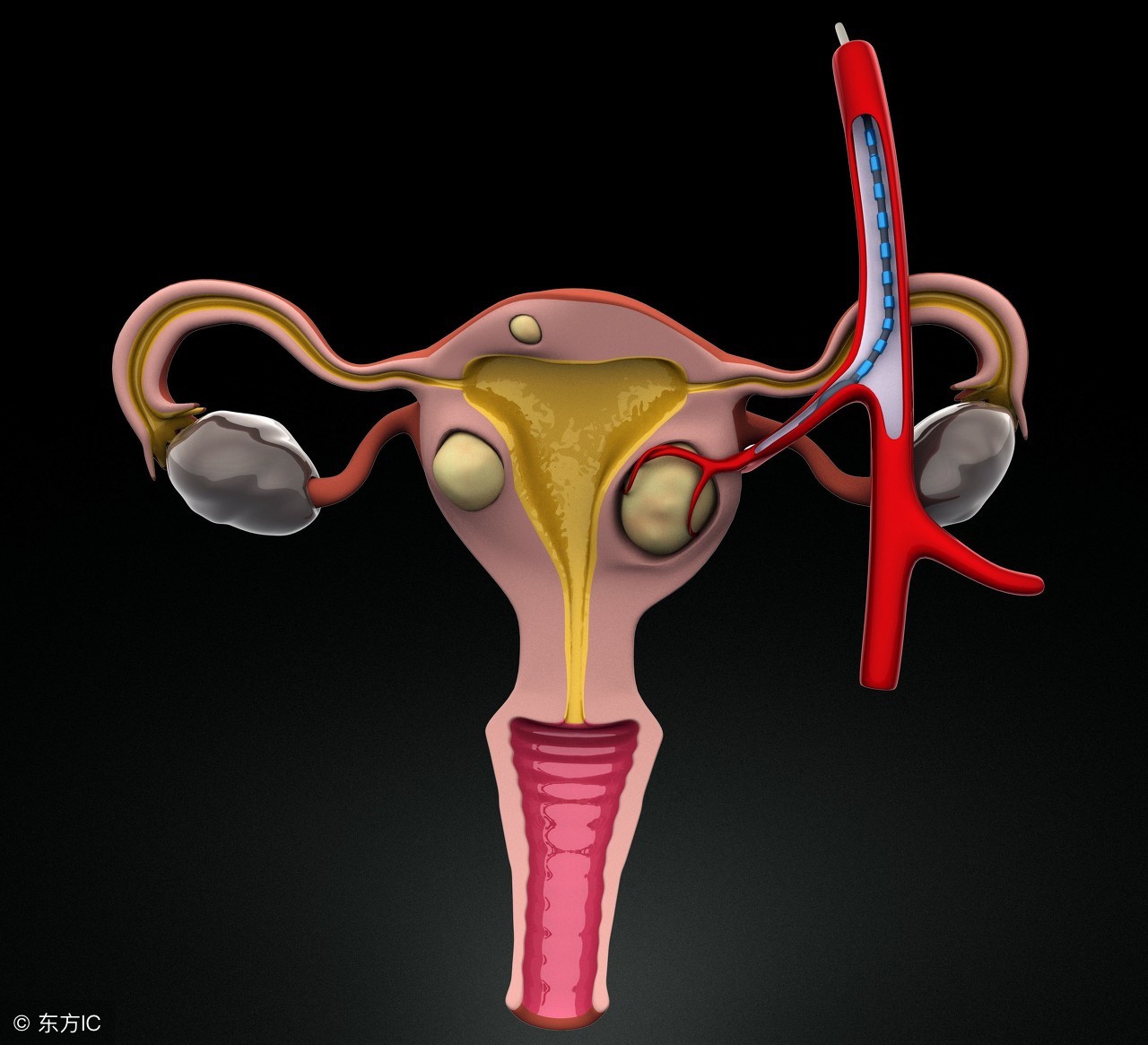 tct检查出宫颈癌怎样治疗,宫颈癌前病变就一定有宫颈癌吗