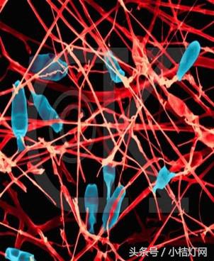 ivd基础知识大全,真菌检测要点