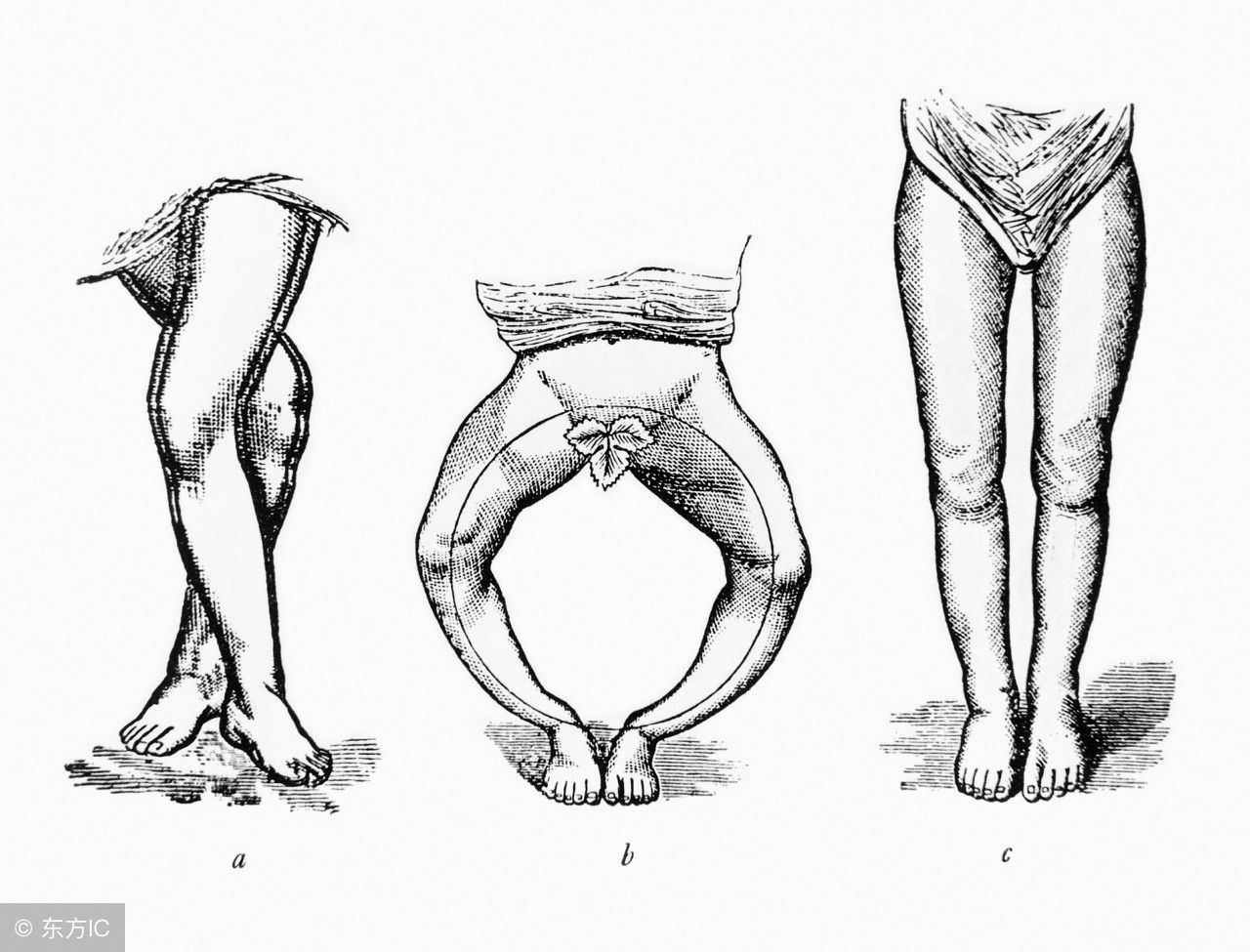 小孩缺维生素d的症状怎么补充,7-12岁儿童每天需要补充维生素d吗