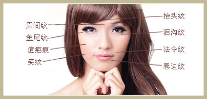 女生笑起来有笑纹,女生有笑纹怎么办