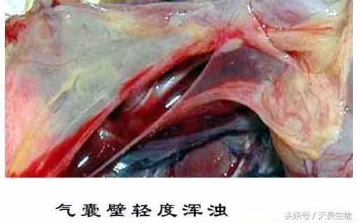 万病之源始于毒素,万病之源起于情志不畅