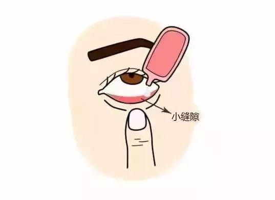 一瓶眼药水,为什么专家建议慎用眼药水