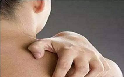 后背长了一个螨虫大疙瘩怎么去除,两天不洗澡就后背长痘痘是螨虫吗