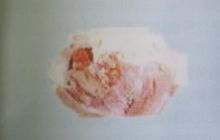 猪丹毒图片,认识猪病